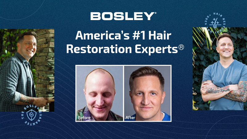 Bosley - Hair Restoration & Transplant - Tysons Corner
