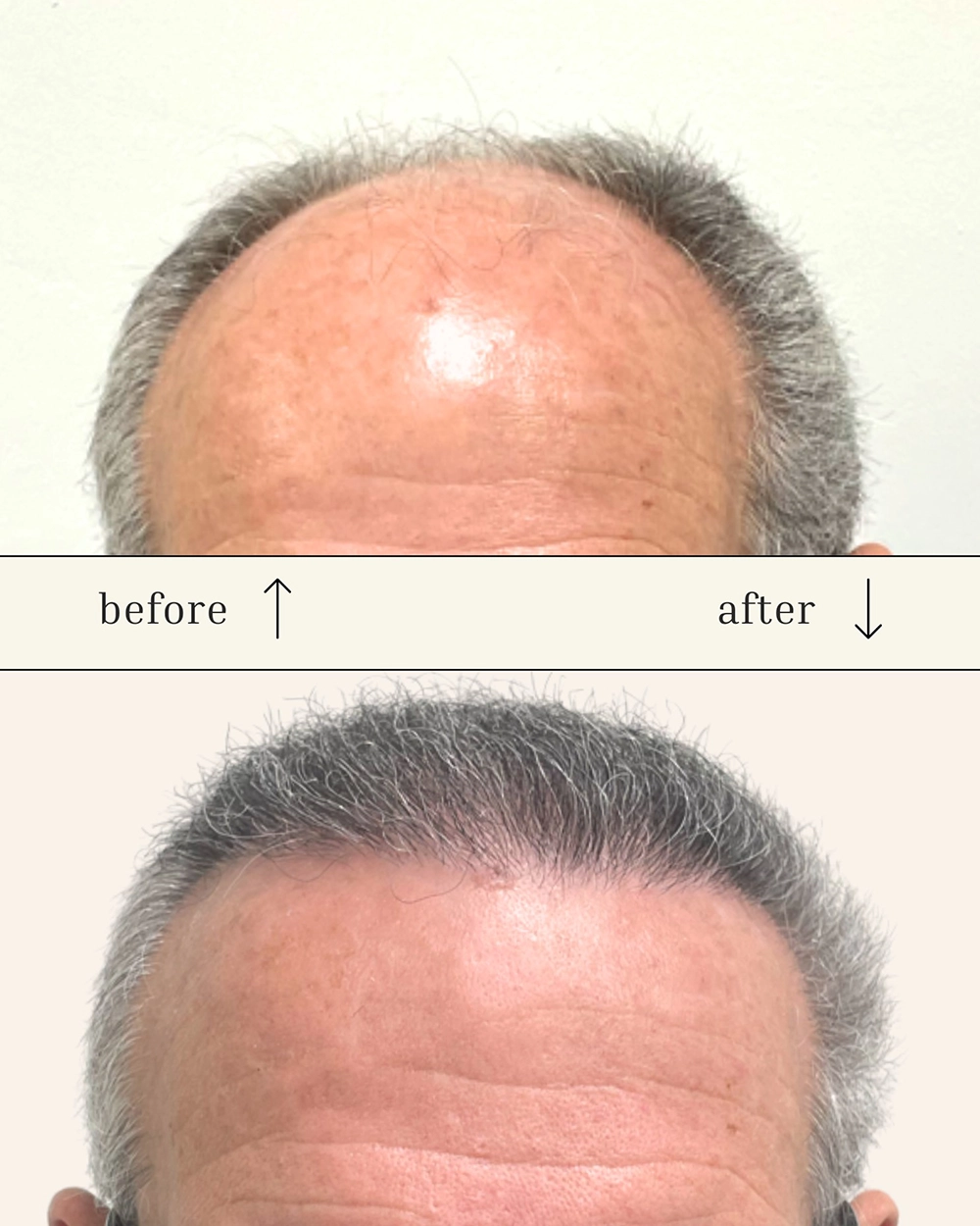 Flintridge FUE Hair Clinic & Wellness