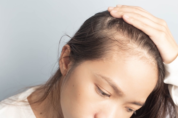 Anagen Hair Restoration